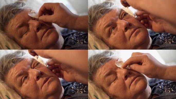 白内障手术后滴眼术。给老妇人的眼睛加眼药水。