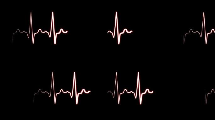 心跳监视器EKG线监视器显示万人迷