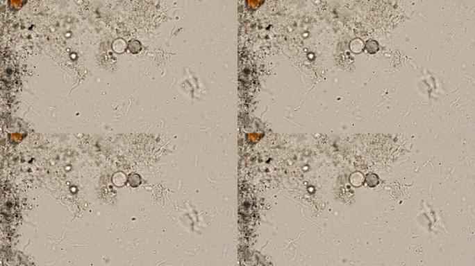 显微镜下废水中的原生动物寄生虫、细菌和藻类。