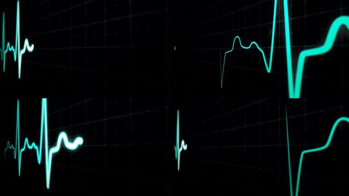 心脏冲动序列在特写