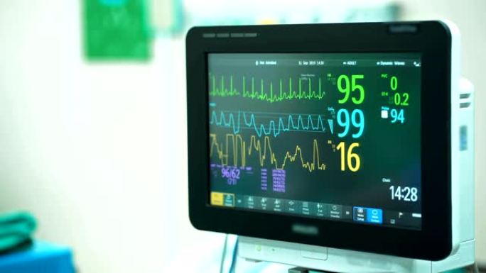 手术室4k心脏监护仪。心电监护仪显示患者背景的心率