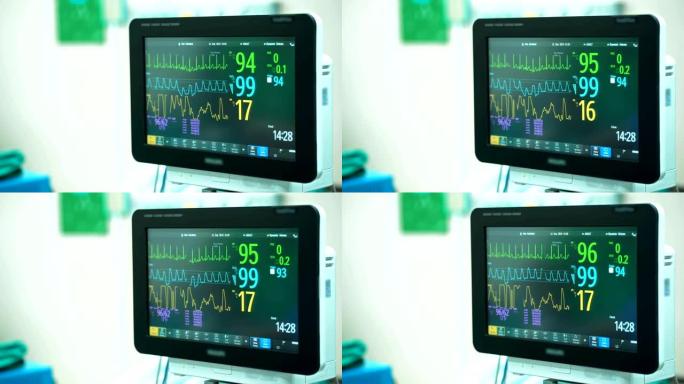 手术室4k心脏监护仪。心电监护仪显示患者背景的心率