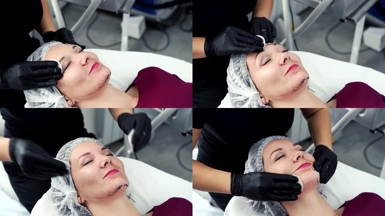 激光脱皮后，美容师用黑色面膜上的湿棉垫清洁女性皮肤