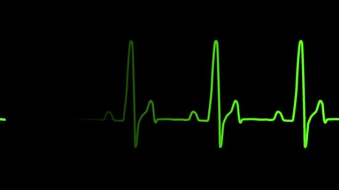 心电图EKG图与人的心跳声音