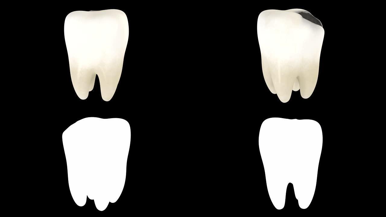 带有alpha层的蛀牙的3D动画