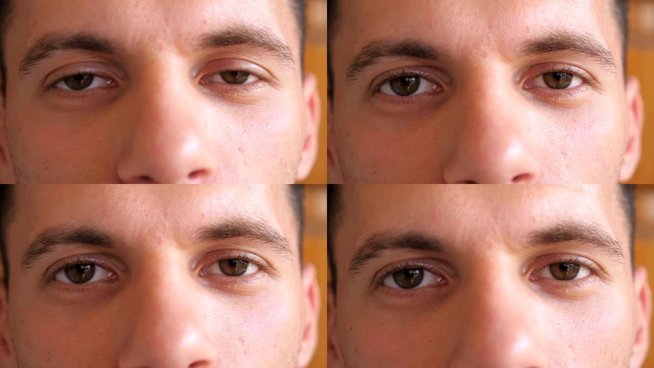 细节视图男人的棕色眼睛凝视着疲惫的眼睛。男性脸的肖像带着失望的情绪看着镜头。绝望的年轻人的面部表情。