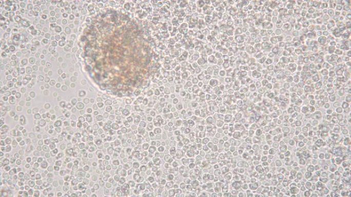显微镜下发芽的酵母细胞。