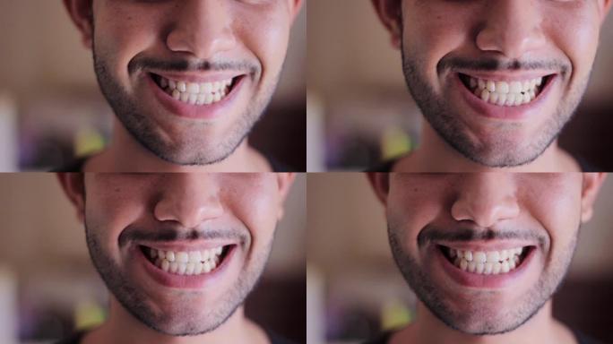 男子展示他的黄色牙齿健康牙齿护理