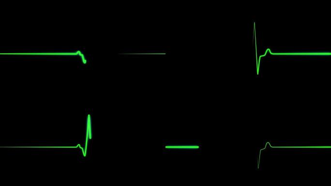 心跳扁平线，带绿线的医用心电图心电图监护仪