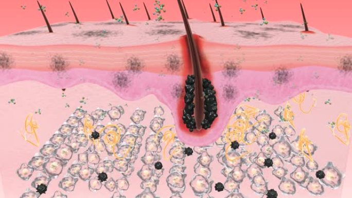 去除毛囊污垢化妆品广告影视特效素材动画演