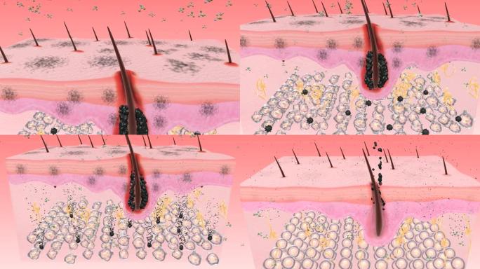 去除毛囊污垢化妆品广告影视特效素材动画演