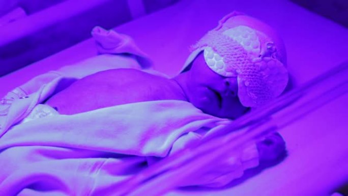 新生儿躺在蓝色的灯下。