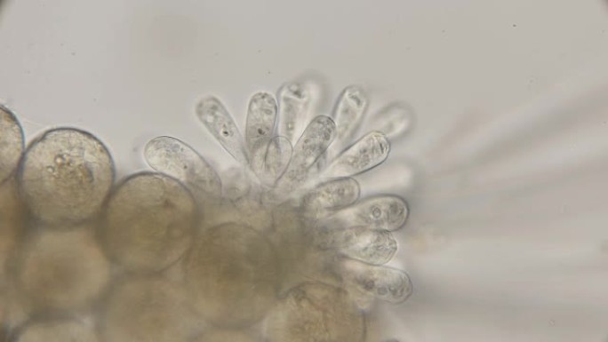 在显微镜下，寄生虫定居在甲壳类独眼巨人的卵上
