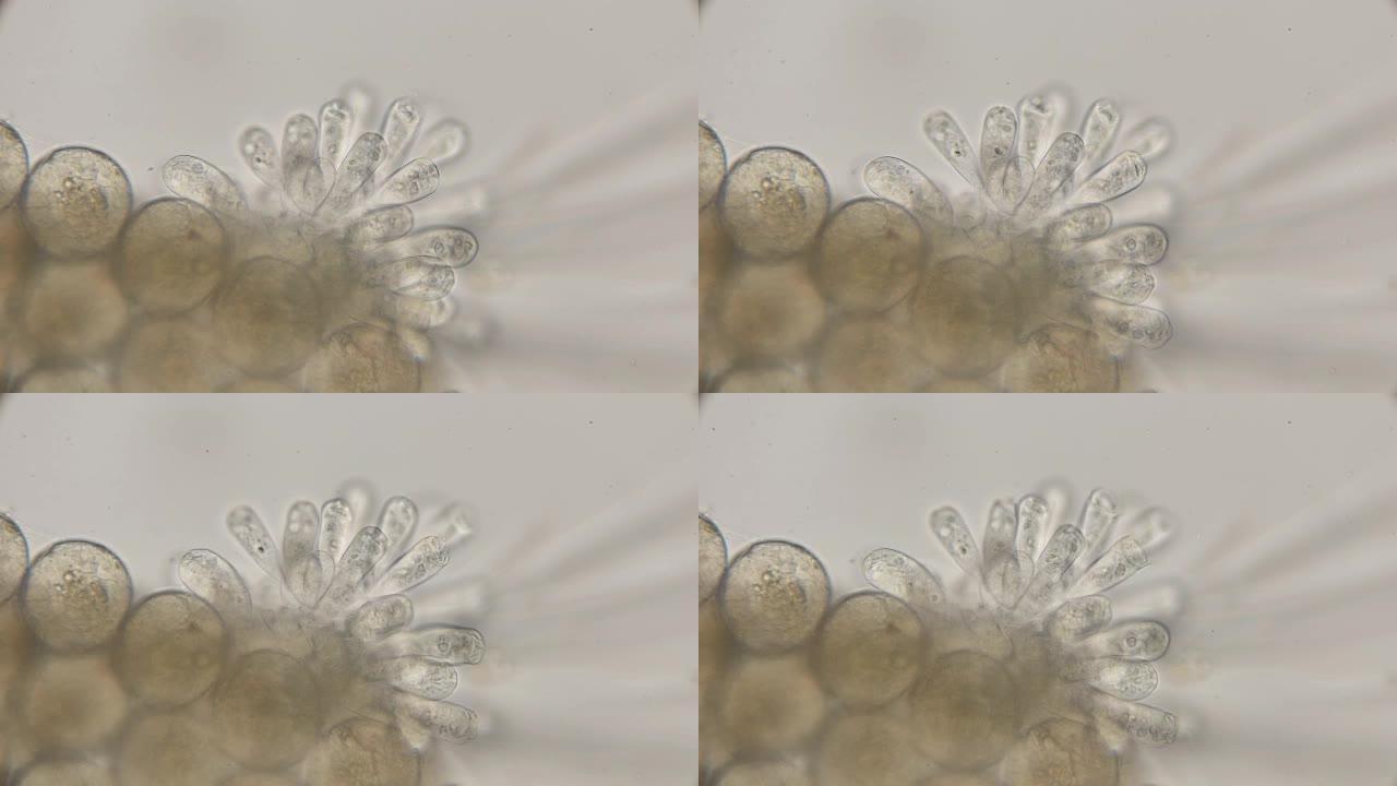 在显微镜下，寄生虫定居在甲壳类独眼巨人的卵上