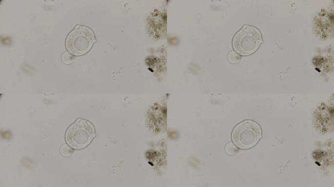 钟形纤毛虫涡虫在显微镜下自由游泳