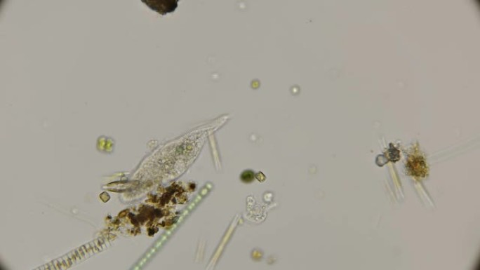 显微镜下纤毛输注Uroleptus