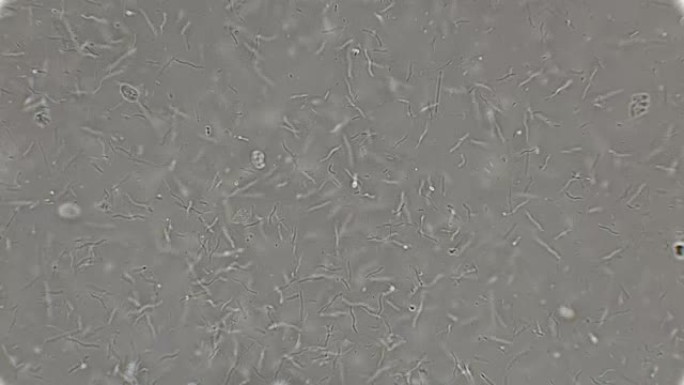 显微镜下细菌螺旋体的菌落