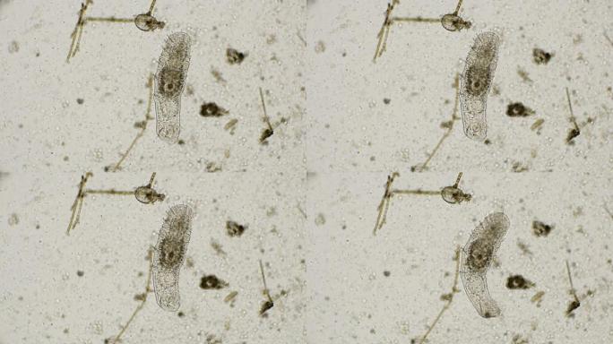 显微镜下的eolosomatidae科寡虫虫种