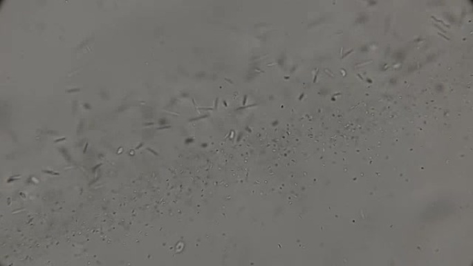 在肮脏的烂水中生活的细菌菌落: 弧菌，螺旋菌，显微镜下的杆状细菌
