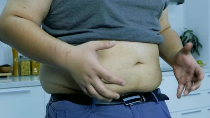 触摸并检查胖子的大肚子。当今社会的概念保健和肥胖