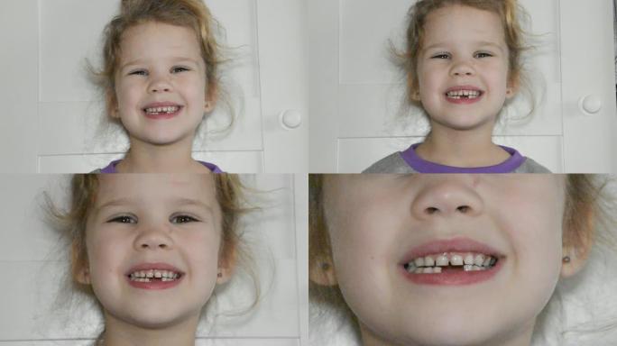 一个女孩，一个孩子失去了牙齿，洞，口腔卫生
