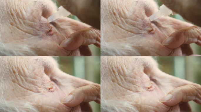 老妇人在她的眼睛里滴药水的侧写。感染和眼睛发炎的祖母肖像。医疗保健和医学的概念。侧视图关闭慢动作