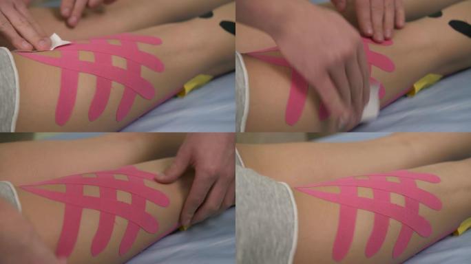 大腿后部的特写镜头，上面有六个粉红色的胶带，男性的手用纸背衬摩擦它们。在大腿后部血肿的情况下进行运动