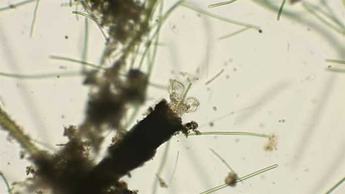 轮虫flooscularia ringens通过旋转纤毛过滤水，在显微镜下通过旋转纤毛过滤水，在显微