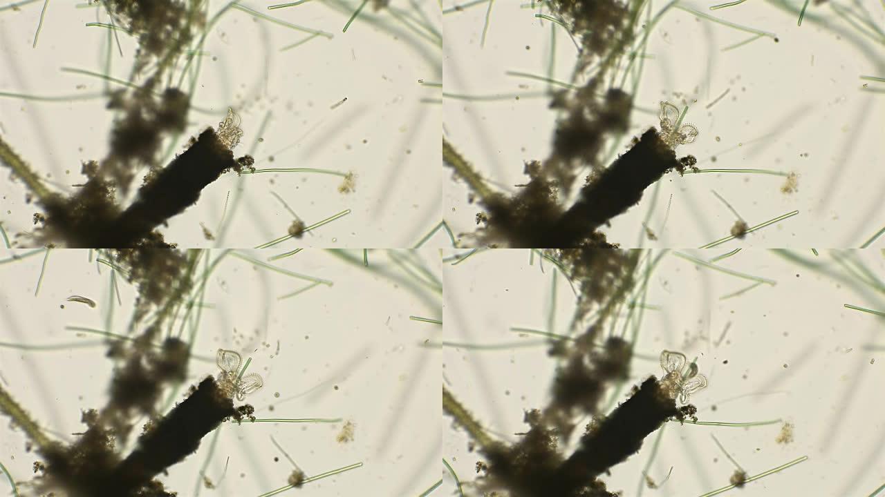 轮虫flooscularia ringens通过旋转纤毛过滤水，在显微镜下通过旋转纤毛过滤水，在显微
