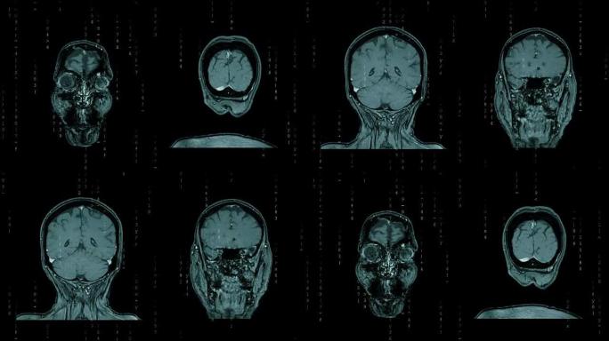 人体头部和浮动代码的MRI扫描