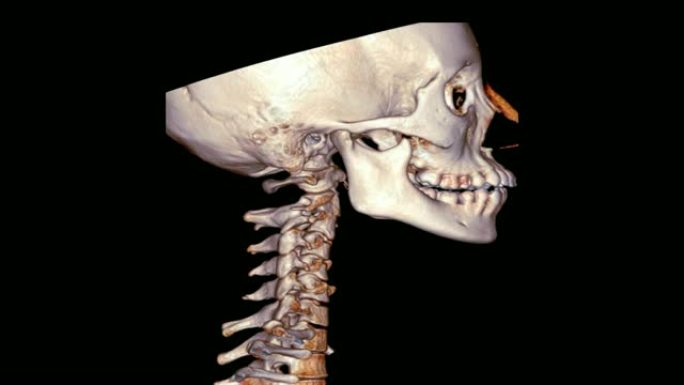 颈椎 (C-Spine) 的ct扫描3D渲染图像在黑色背景上旋转。
