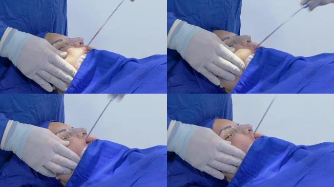 外科医生对女性患者进行鼻中隔偏曲后面部吸脂和隆鼻手术。全身麻醉的女性患者。