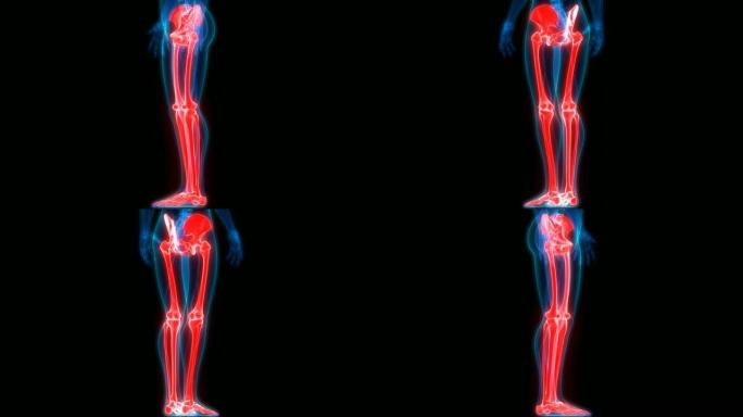 人体骨骼系统下肢解剖