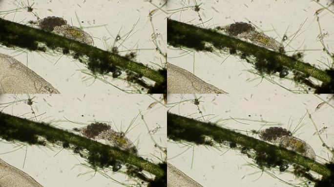 在显微镜下有卵的雌性熊Tardigrada