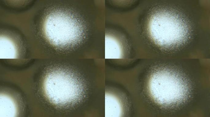 显微镜下的芽殖酵母细胞。