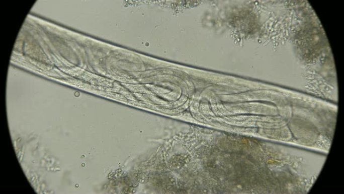 雌性Turbatrix aceti内的幼虫