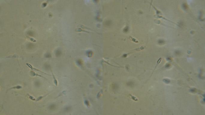 在显微镜下观察的精子。在相衬显微镜下移动的人类精子。特写显示精子。在显微镜下录像精液。4 k UHD