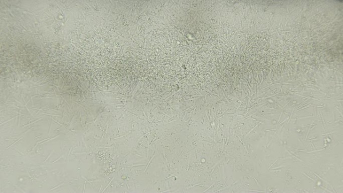 腐烂生物中出现的杆状细菌菌落