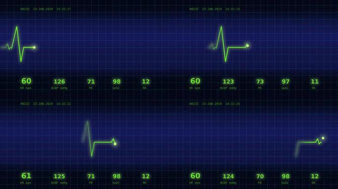 监视器上的心跳图6