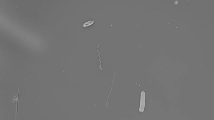 蓝藻节螺旋藻的运动，以前在显微镜下称为螺旋藻