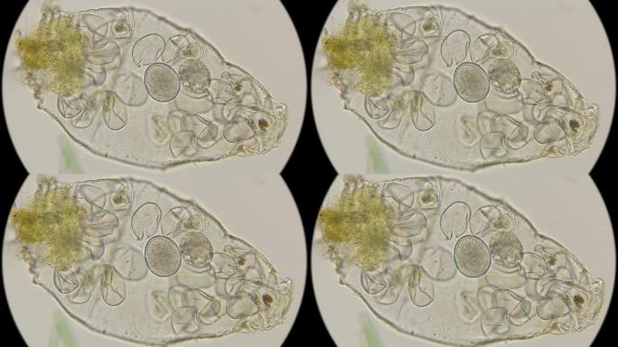 带有胚胎Tardigrada的卵，在显微镜下