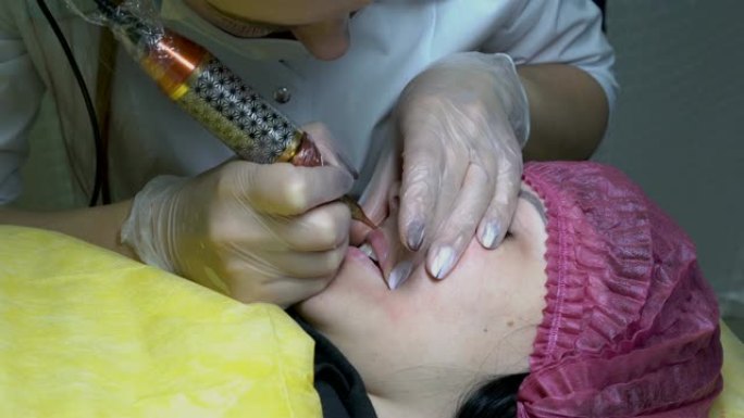 一个年轻女孩在美容院做着永久化妆嘴唇的手术。美容师针扎她的颜料在嘴唇上。