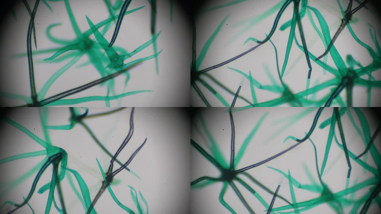 叶片表皮w.M.的支状星状毛在光学显微镜下