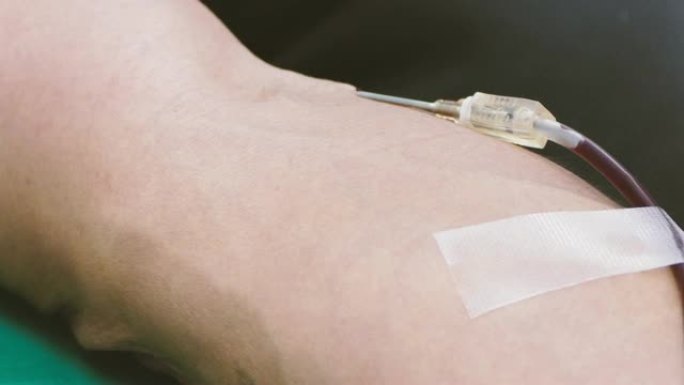 护士技术人员采集献血