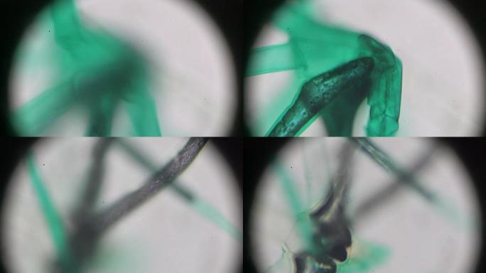 叶片表皮w.M.的支状星状毛在光学显微镜下