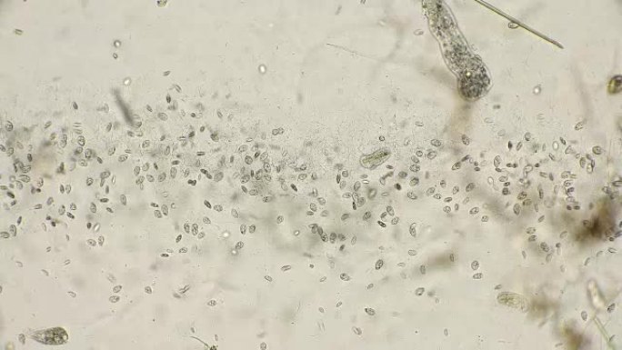 一个大的微生物菌落，在显微镜下