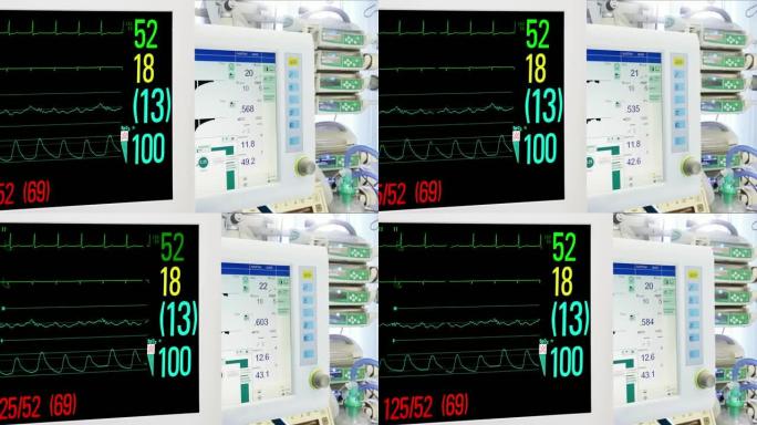 重症监护病房的医疗设备。心脏和生命体征监测。