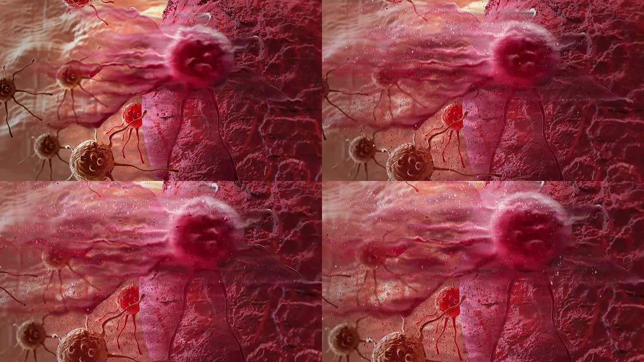 破坏和分解的癌细胞的动画