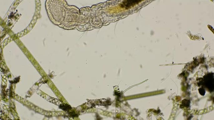 蠕虫，在显微镜下