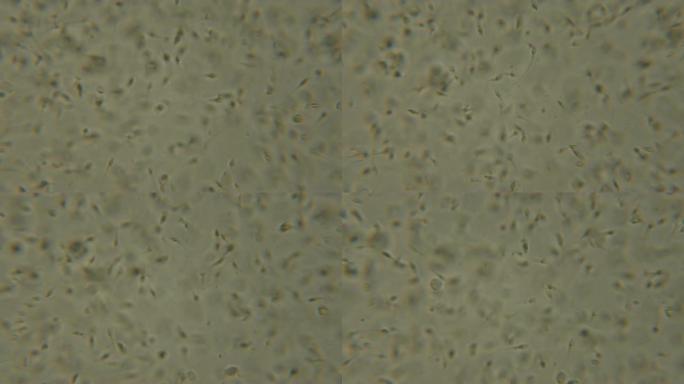 在显微镜下观察的精子。在相衬显微镜下移动的人类精子。特写显示精子。在显微镜下录像精液。4 k UHD